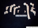 L_V20d5009 A16.60 R814 lR ta femorae multiple burial.JPG L_V20d5009 A16.60 R814 lR ta femorae multiple burial